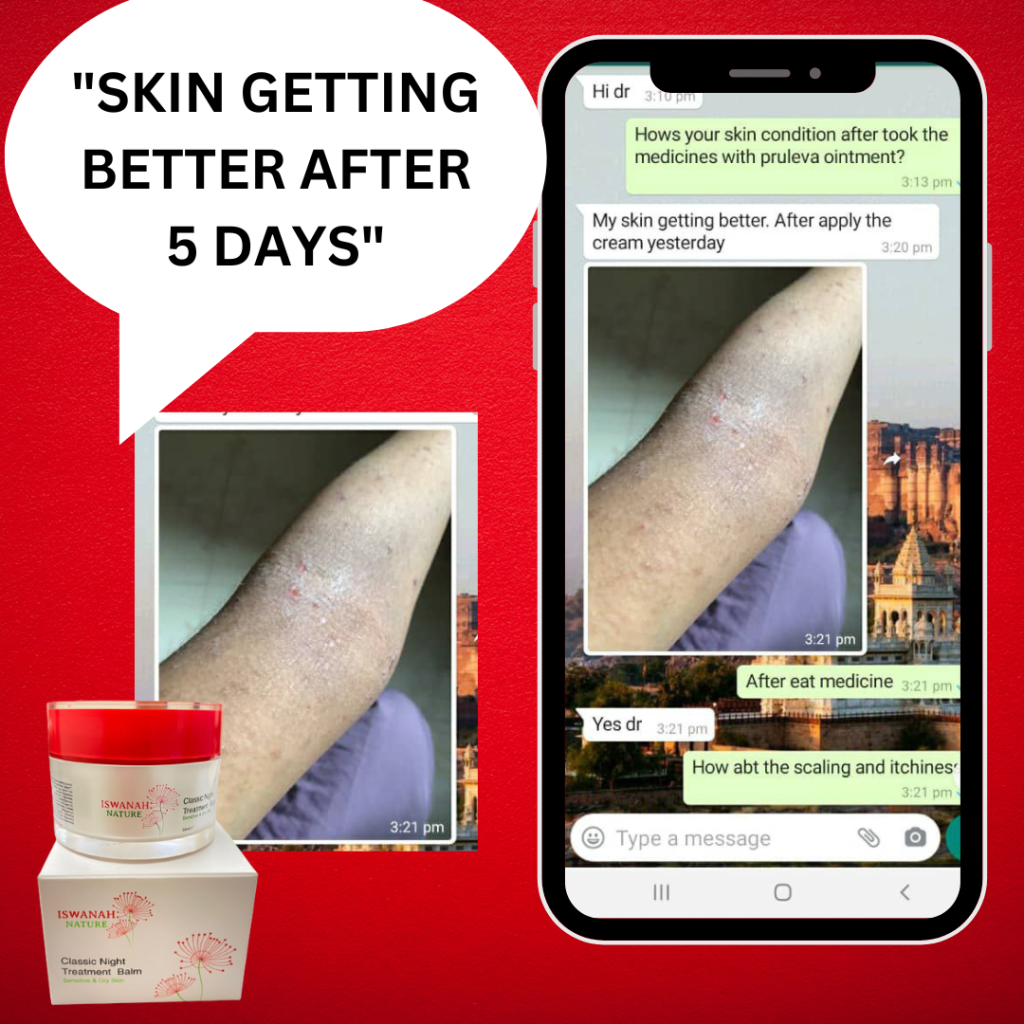 krim psoriasis terbaik
