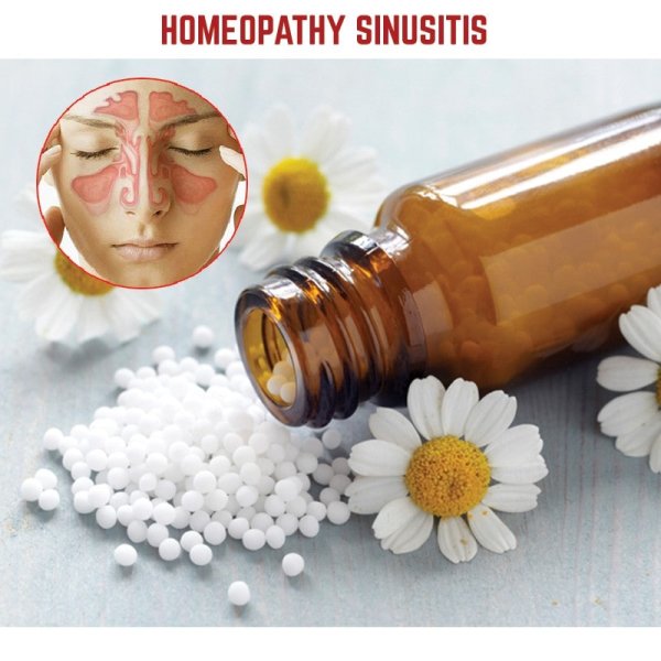 homeopathy sinusitis